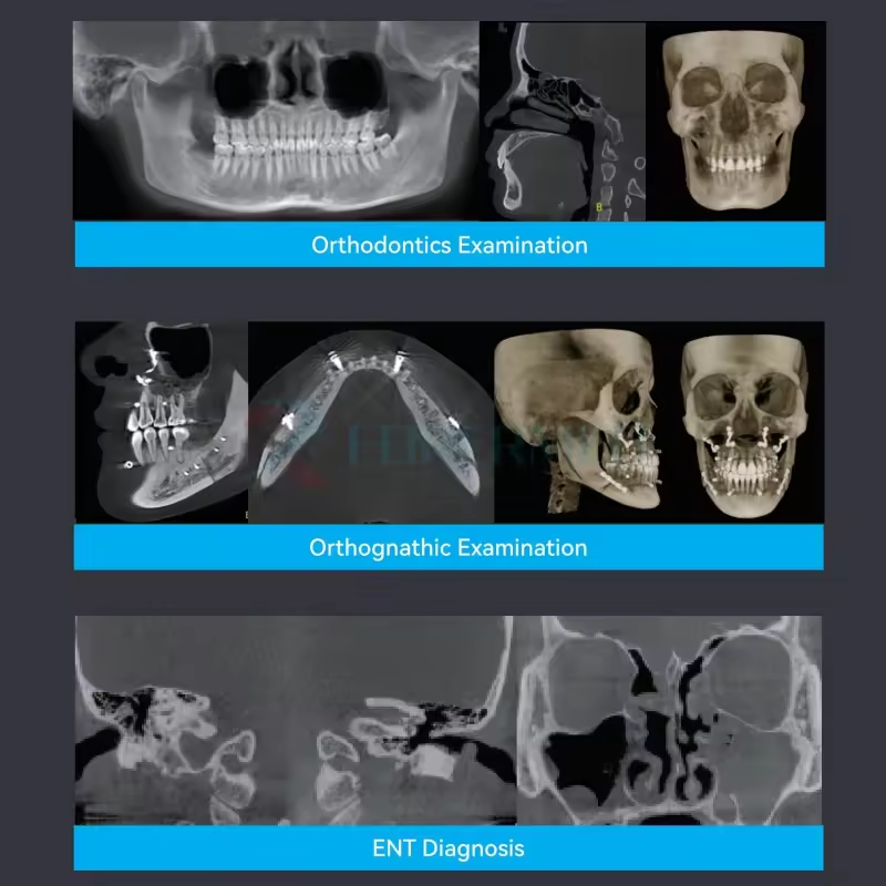 D0101 Hepsi bir arada 3D Serisi Profesyonel CBCT X-Ray Panoramik Diş Sefalometrik FOV 23x18cm Sef Pan CBCT