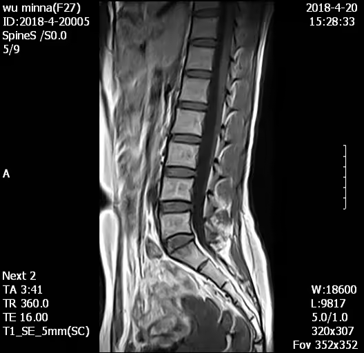 H0038 MY-D054 Hastane Tıbbi 0.5T MRI tarayıcı/tarama/makine ekipman fiyatı satılık