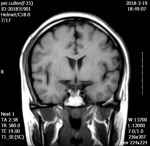 H0038 MY-D054 Hastane Tıbbi 0.5T MRI tarayıcı/tarama/makine ekipman fiyatı satılık